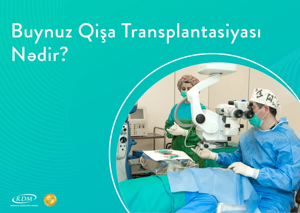 Buynuz Qişa Transplantasiyası Nədir?