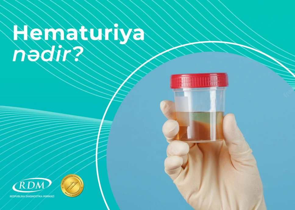 Hematuriya nədir?